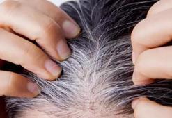 Can sıkıcı beyaz teller için 2 su bardağına 1 tatlı kaşığı yetiyor!