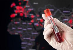 Maymun çiçeği virüsüne karşı ilk aşıya onay verildi