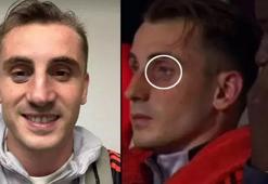 Kerem Aktürkoğlu gözüne darbe aldı, morluk oluştu!