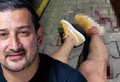 Fenerbahçeli eski futbolcu ve yorumcu Serhat Akın'a silahlı saldırı: Ayağıma sıktılar