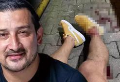 Serhat Akın'a silahlı saldırıda yeni gelişme! 2 kişi yakalandı