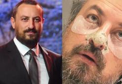 Onur Saylak gözaltı ve siyah noktalarına bakım yaptı!