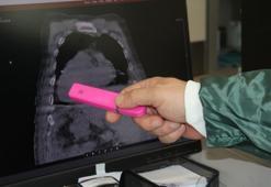 Dünyada bir ilk: Doktorlar o hastalığa Giresun Sendromu ismini verdi!