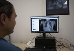 Aydın'da sıra dışı vaka! Doktorlar bile inanamadı, röntgende gerçek ortaya çıktı