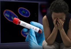 AIDS'li çocuk alarmı! 13 yaşında öldü, yeni tehlikeyi açıkladı, vakalarda büyük artış