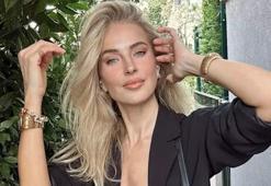 Burcu Esmersoy'dan estetik iddialarına yanıt!