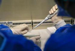 DSÖ, M çiçeği virüsüne karşı LC16m8 aşısına onay verdi