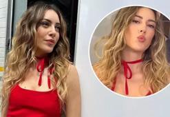 Sinem Kobal mini elbisesiyle göz doldurdu! Estetik yüzünden okundu