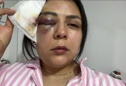 Yolda yürürken genç kıza yumruk attı! Korku dolu anları anlatırken saldırgan tutuklandı