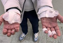 Esenyurt'ta köpek sürüsünün saldırısına uğrayan vatandaş yaralandı