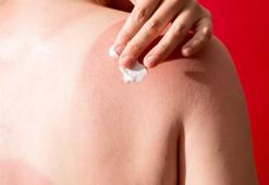 Cam kapalı olsa da güneş ışığı cildinize zarar verebilir mi?