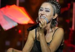 Yüzü yanmıştı! Yıldız Tilbe son halini sahnede gösterdi