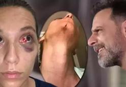 Eski sevgilisi Deniz Bulutsuz'u darp ettiği iddiasıyla yargılanan Ozan Güven'e 11 yıl hapsi cezası istemi