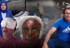 Görüşme isteğini reddeden kadına kezzaplı saldırı! 'Sesimi duyun, gözlerimden kan geliyor'