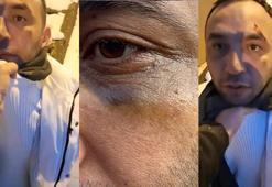 Kağıthane'de sevgili tuzağı! Darp edip kimliğini aldılar