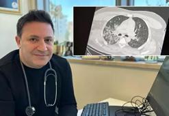 Gençlerdeki ani ölümlerin nedeni belli oldu! Virüs damar hasarına neden oluyor