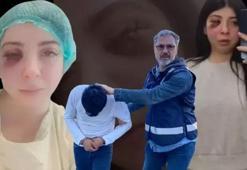Samsun'da yolda yürürken sözlü tacize uğramıştı! Yüzümün sol tarafını hissetmiyorum