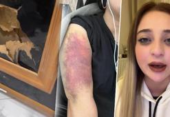 Eski sevgili dehşeti! Şantaj, küfür, hakaret ve şiddete uğradı mahkeme sanığı serbest bıraktı