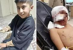 Eslem, Rana şimdi de Murat... Erzurum'da bakkala giden küçük çocuk dehşeti yaşadı! 'Boğazında diş izleri vardı'