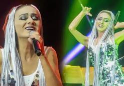 Saç boyasından yüzü yanmıştı! Yıldız Tilbe günler sonra görüldü