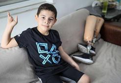 Antalya'da protez kredisinin icrası hayırsever tarafından ödendi