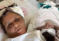 İzmir'de gelin dehşeti yaşattı! Yufka yüzünden kaynanasını tuğlayla dövdü