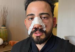 Ankara'da siparişi geç kalınca restorandan çıkmak isteyen vatandaş çalışanlar tarafından darp edildi