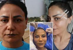 Antalya'da estetik kabusu! 220 bin TL'ye bıçak altına yattı, hayatı alt üst oldu