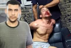 Dişleri kırılıp, hamam böceği yedirildi! 3 günlük işkencede şok rapor