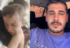 Darp sonucu hastanelik olan bebek, devlet korumasında! Anne ile sevgilisi gözaltına alındı