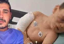 2 yaşındaki çocuğa vahşeti yaşattı: Annesinin sevgilisi tarafından dövülen çocuk yoğun bakımda!