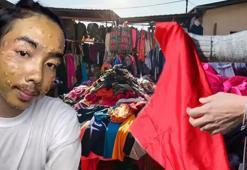 Satın aldığı kıyafeti yıkamadan giydi, hayatı alt üst oldu! Uzmanlar uyardı