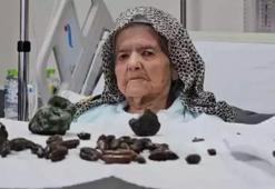 Eşini kaybetti 92 yaşında kızına sığındı! Hastalığını keşfeden doktorlar bile şoke oldu
