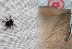 Sivas, Tokat ve Yozgat’ta yoğun olarak görülüyor! Bu belirtileri taşıyanlar dikkat