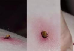 Keneler can almaya devam ediyor! Nereden ısırdığı çok önemli! Uzmanlar Karadeniz ve İç Anadolu’ya dikkat çekiyor