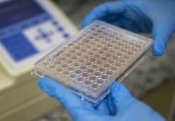 Kimyasalı yok, çocuklar da kullanabilecek! Bolu'da akademisyenler geliştirdi: İçeriğinde Bor madeni ve biberiye özü var