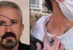 18 bıçak darbesiyle yaraladığı eşin cezası Yargıtay'dan döndü