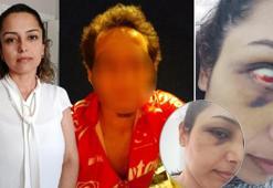 Genç kadının evlilik hayali kabusa dönüştü! 'Hamileyken şiddet uyguladı, bebeğimi kaçırdı, aracımı çaldı'