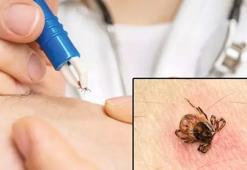 Türkiye'de 7 şehirde görüldü! Kene hakkında doğru bilinen 10 yanlış