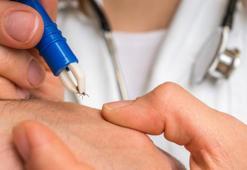 Yaz geldi Adana'da kene vakaları artmaya başladı! Uzmanlar uyarıyor: Belirtiler ihmal edilmemeli