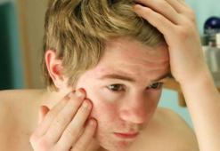 Ergenlik ne zaman biter? Kız ve erkek çocuklarında ergenliğin bittiği yaş