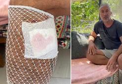 Muğla'da köpek saldırısına uğrayan vatandaşın bacağına 5 dikiş atıldı! Belediyeden şikayetçi oldu