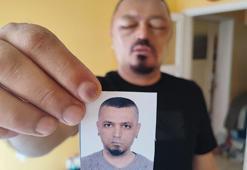 Berber tavsiyesi hayatını kabusa çevirdi! İnternetten satın aldı, yüzü tanınmayacak hale geldi