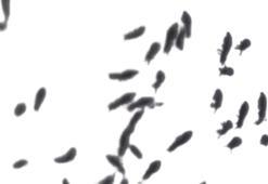 Kar piresi nedir, insana geçer mi, nasıl temizlenir?