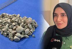 Karın ağrısı şikayetiyle gittiği hastanede literatüre girdi: Doktorlar bile şok oldu: 'Çok şaşırdık, çakıl taşı resmen'