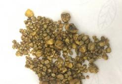 Safra kesesi taşından ameliyat olmadan kurtulan var mı?