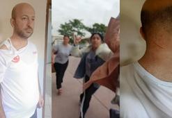 Ankara'da boşandığı eşinin yanında yaşayan oğlunu görmeye giden baba saldırıya uğradı!