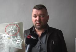 İmplant vidası çenesini delip kafatasına saplandı! 2 yıldır adalet bekliyor