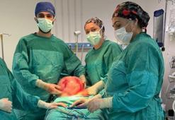 2 ayda karnı büyüdü! Doktorlar sonuca şaşırdı: Karpuz büyüklüğünde çıktı