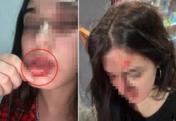 Samsun'da eski sevgili dehşeti yaşattı! Kanlı fotoğraflarını sosyal medyadan paylaştı